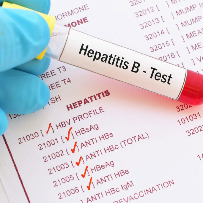 HepB Task Force - Hepatitis B Test